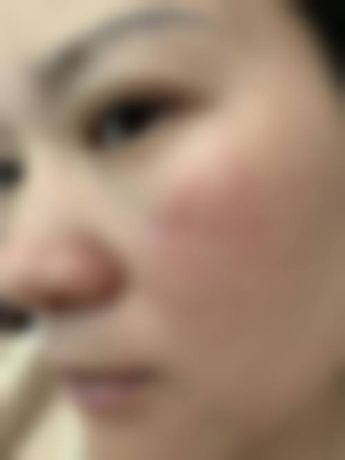 孝感中 心医院整形烧伤外科特色项目及技术优势