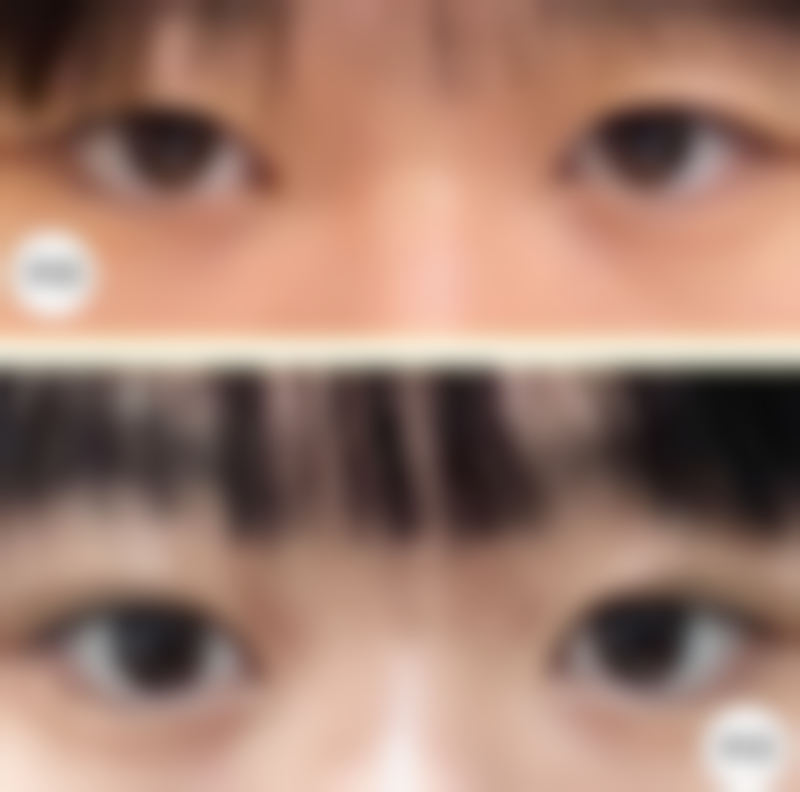 韩国AB整形外科简介概述