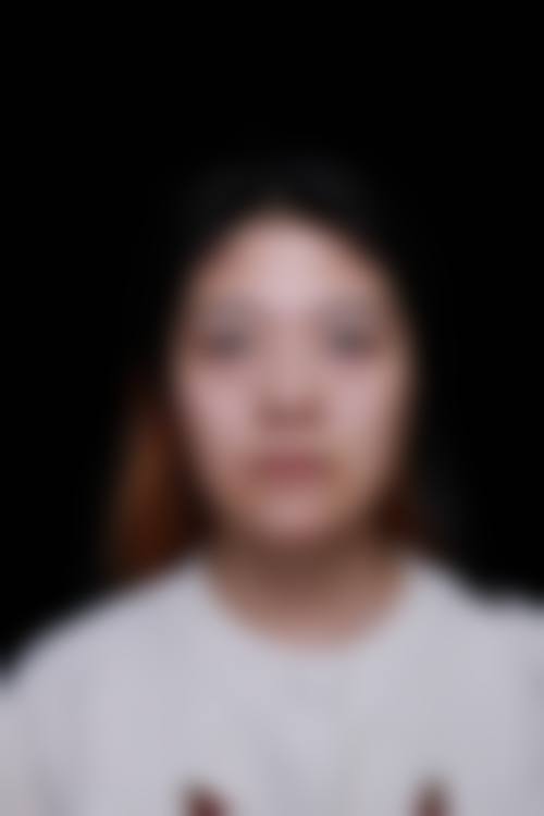 合肥金保立新整形医院价格收费