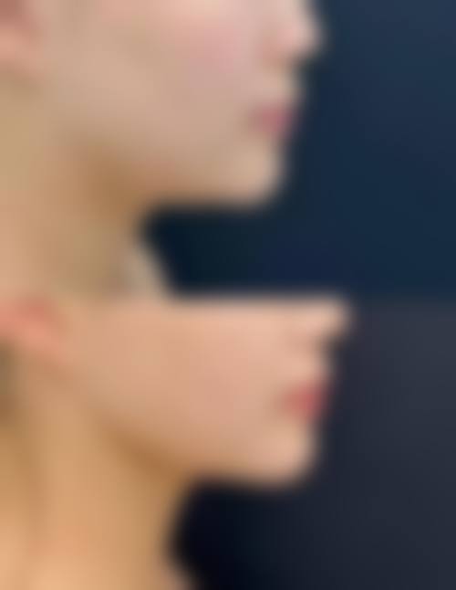 朴炫埈医生主推的特色诊疗技术