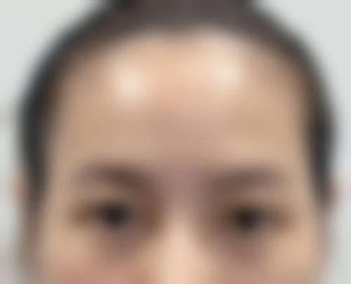 宁波鄞州颜蕾新素整形医院特色项目及技术优势