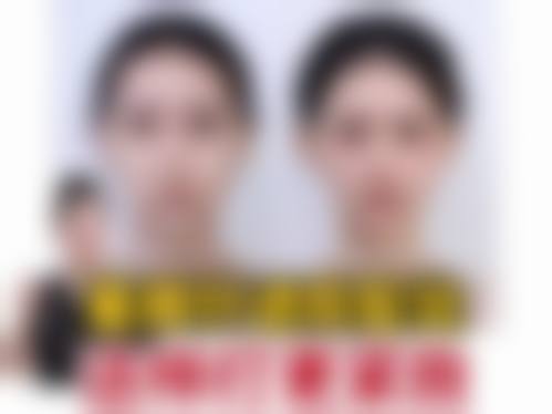 宁波鄞州颜蕾新素整形医院求美者反馈