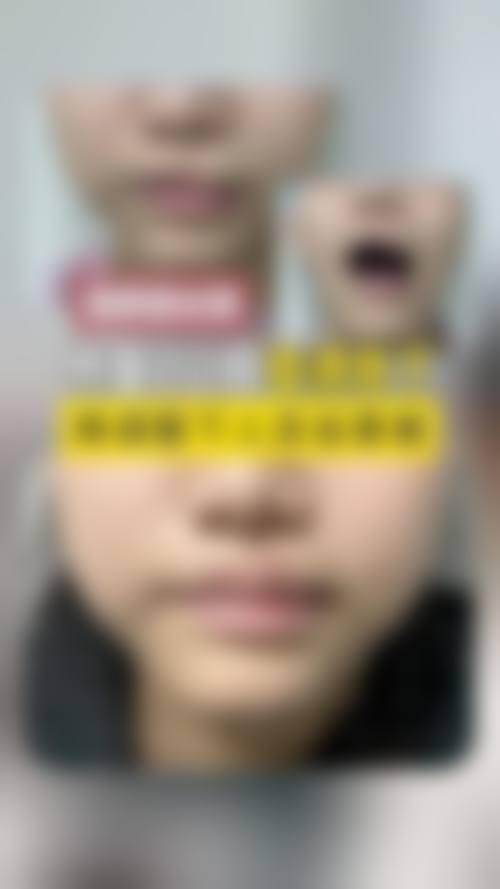 合肥金保立新整形医院求美者反馈