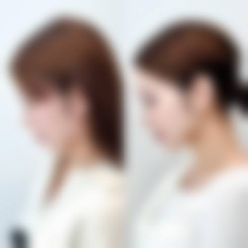 昆明彼心医疗美容诊所求美者反馈