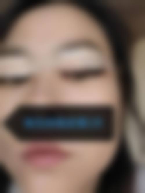 义乌芙洛拉医疗美容价格收费