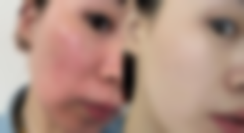 珠海盈美医疗美容门诊部价格收费