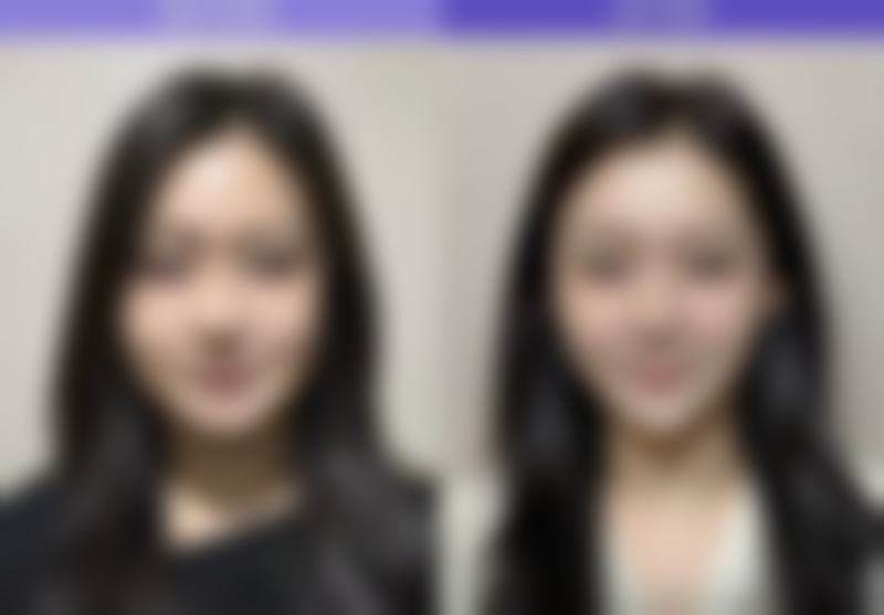 厦门思明银河医疗整形美容医院求美者反馈