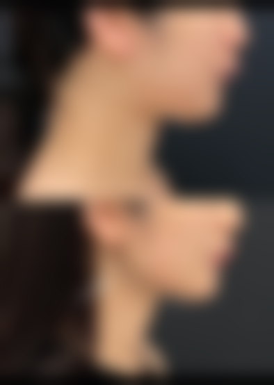 石家庄美莱医疗美容求美者反馈