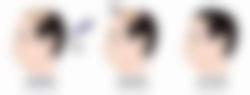 上海徳琳医疗美容医院求美者反馈