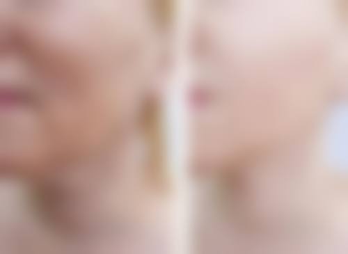 成都锦江新诺亚齿科价格收费