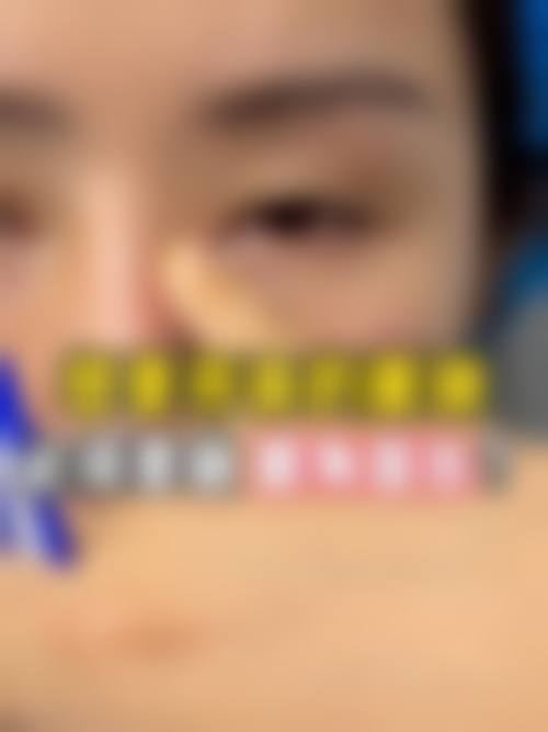 褚健医生践行的医美服务理念