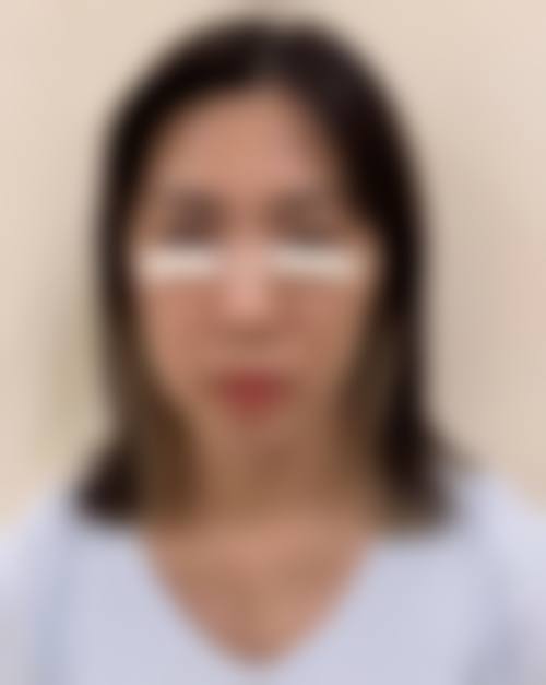 上海欣悦容整形医疗美容医院价格收费