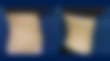 韩国N-Slim吸脂医院来院路线