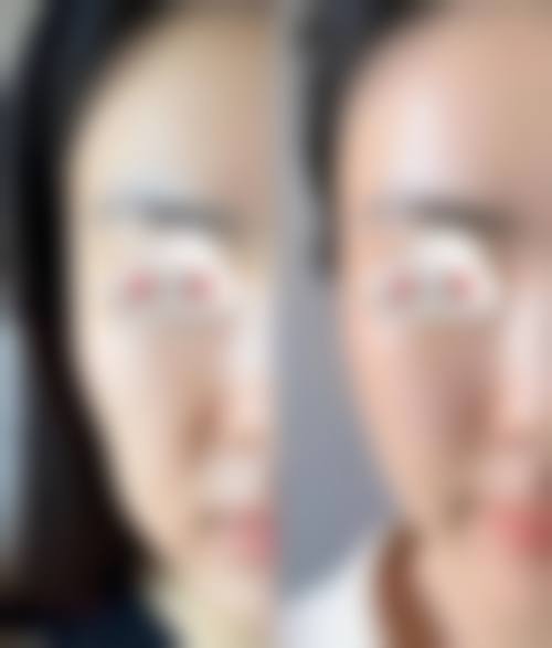 上海永惠华医疗美容门诊部求美者反馈