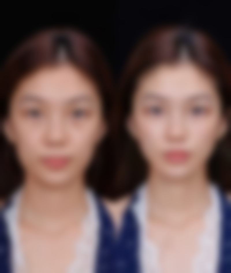 张四文与医美团队的协同提升机制