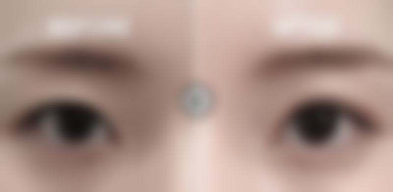 张四文可开展的经典医美项目范围