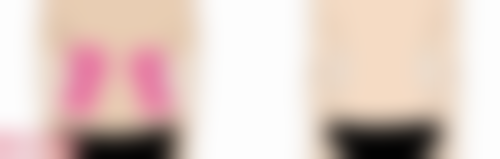 石家庄臻艾医疗美容院求美者反馈