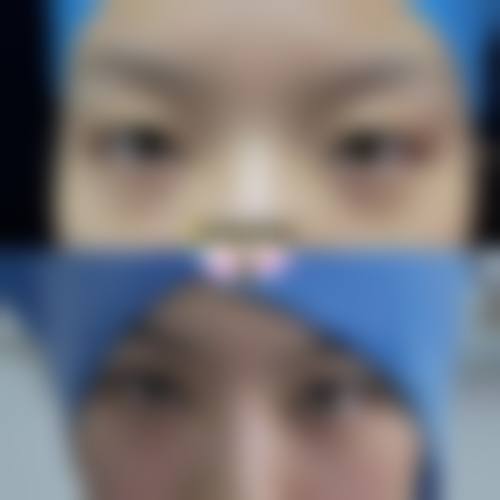 日照医疗美容口腔医院求美者反馈