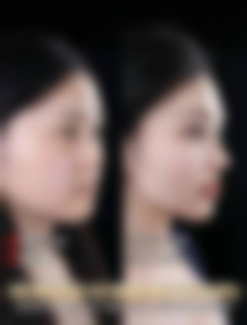 东莞市南城医院价格收费