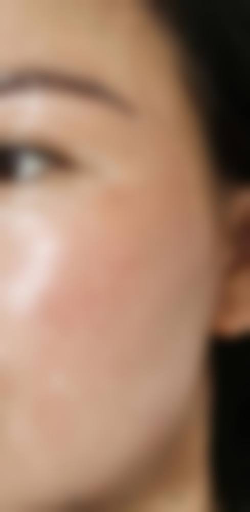 王雪花医生覆盖的全品类医美服务项目