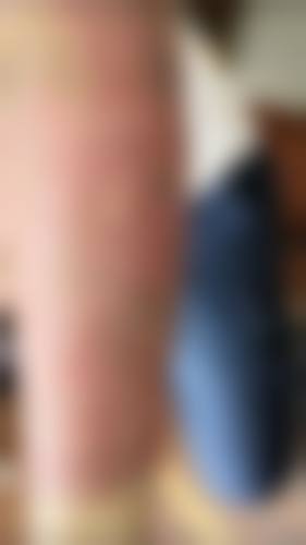 新乡雪俐医疗美容诊所求美者反馈