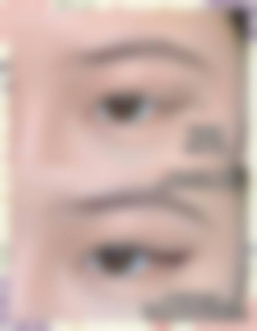 林祥医生的医美技术贴合求美者个性化需求