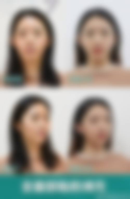 石家庄禧赫整形医院求美者反馈