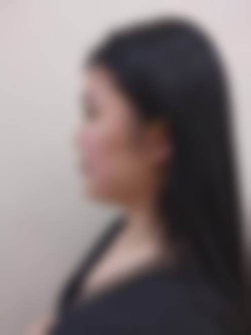 洪剑威医生接诊项目:透明化收费标准