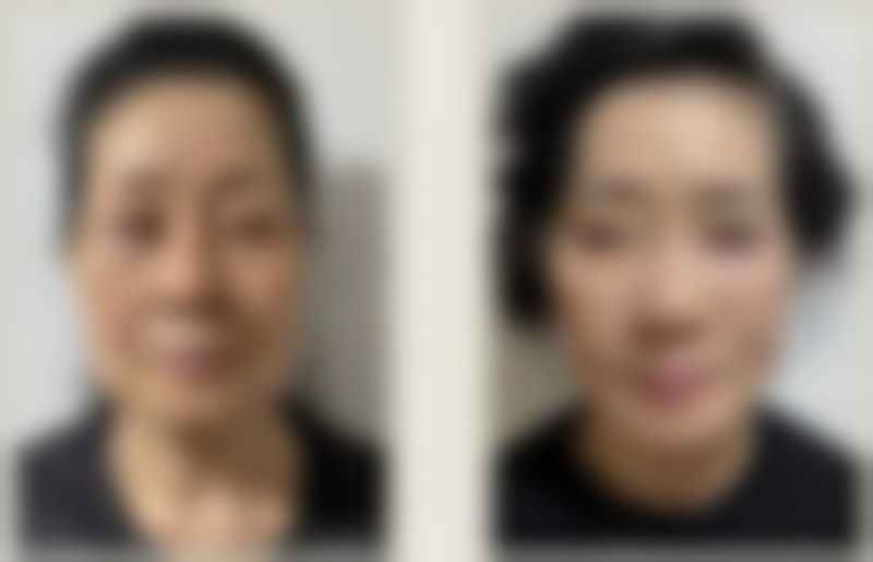 西安美立方整形美容医院价格收费