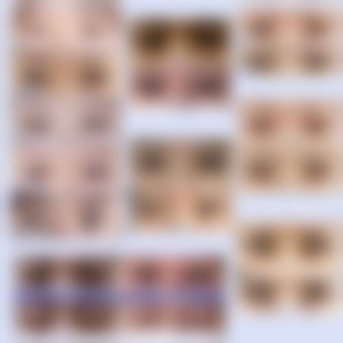 西安多美美诺医疗美容诊所求美者反馈