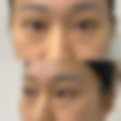 犍为九玺美诺拉整形医院求美者反馈