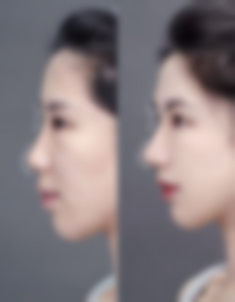 西安多美美诺医疗美容诊所特色项目及技术优势