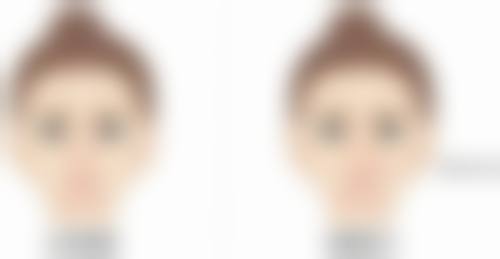 广州庄允贤整形医院特色项目及技术优势