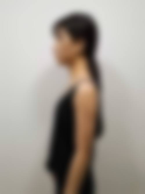 南阳宛城艾美医疗美容门诊部求美者反馈