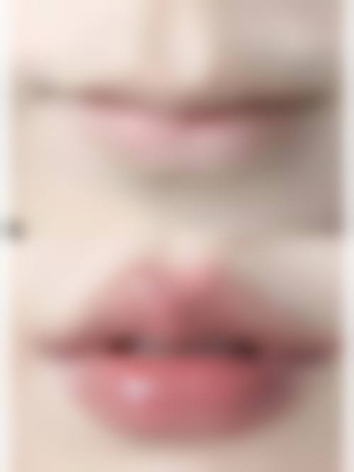 杭州西湖王圣林美容整形医院求美者反馈