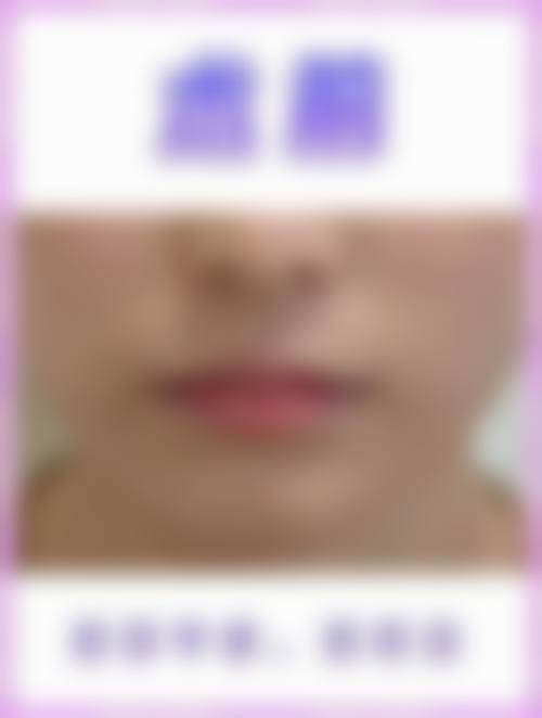 杭州西湖王圣林美容整形医院医生团队实力