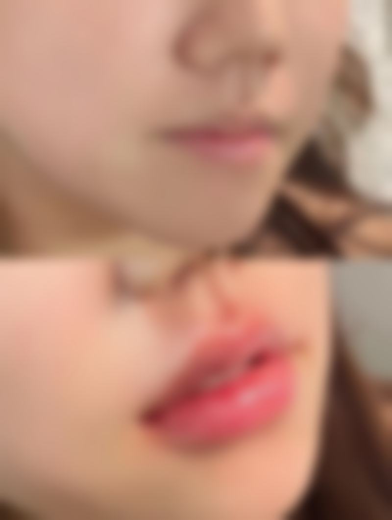 郑州金水缇美思轻医美整形价格收费