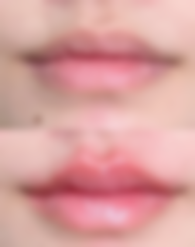 郑州金水缇美思轻医美整形求美者反馈