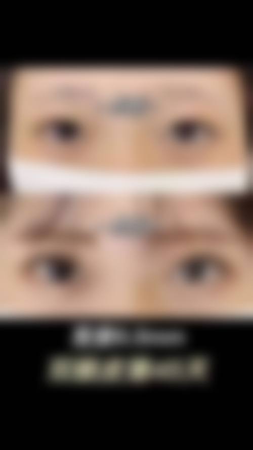 扬州市中医院医学美容中 心价格收费