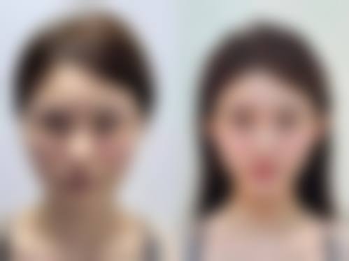 李正友医生的医美服务核心原则