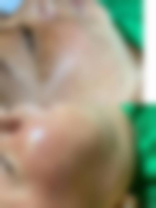 十堰淑梅娅韩医疗美容诊所特色项目及技术优势