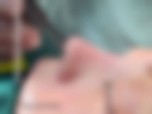 韩国汝好整形外科医院价格收费