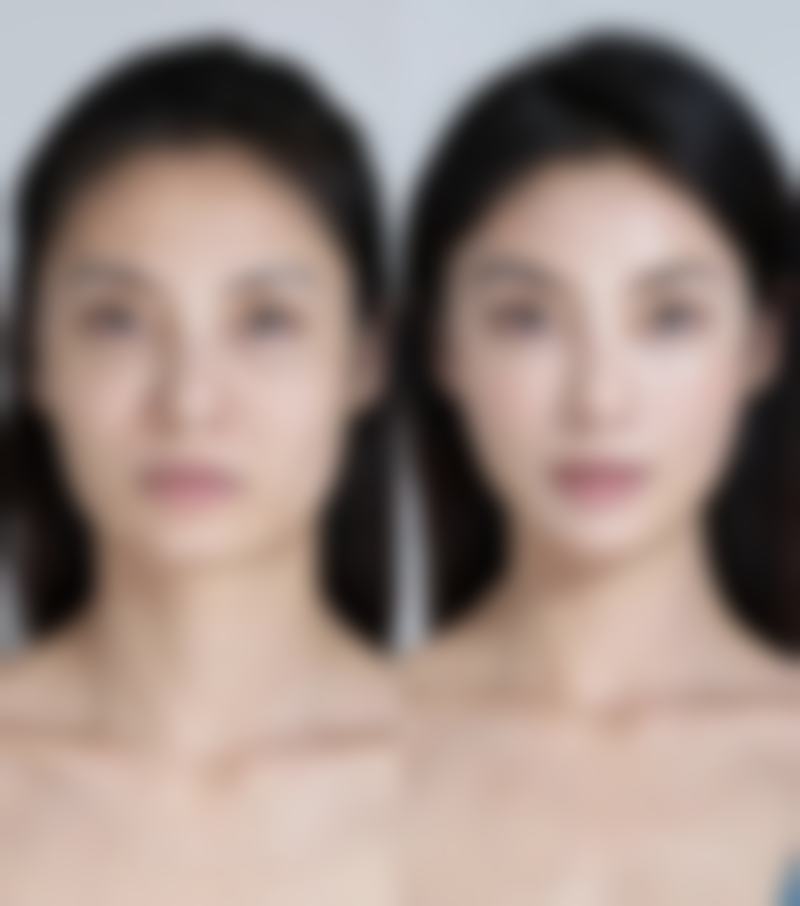 韩国汝好整形外科医院特色项目及技术优势