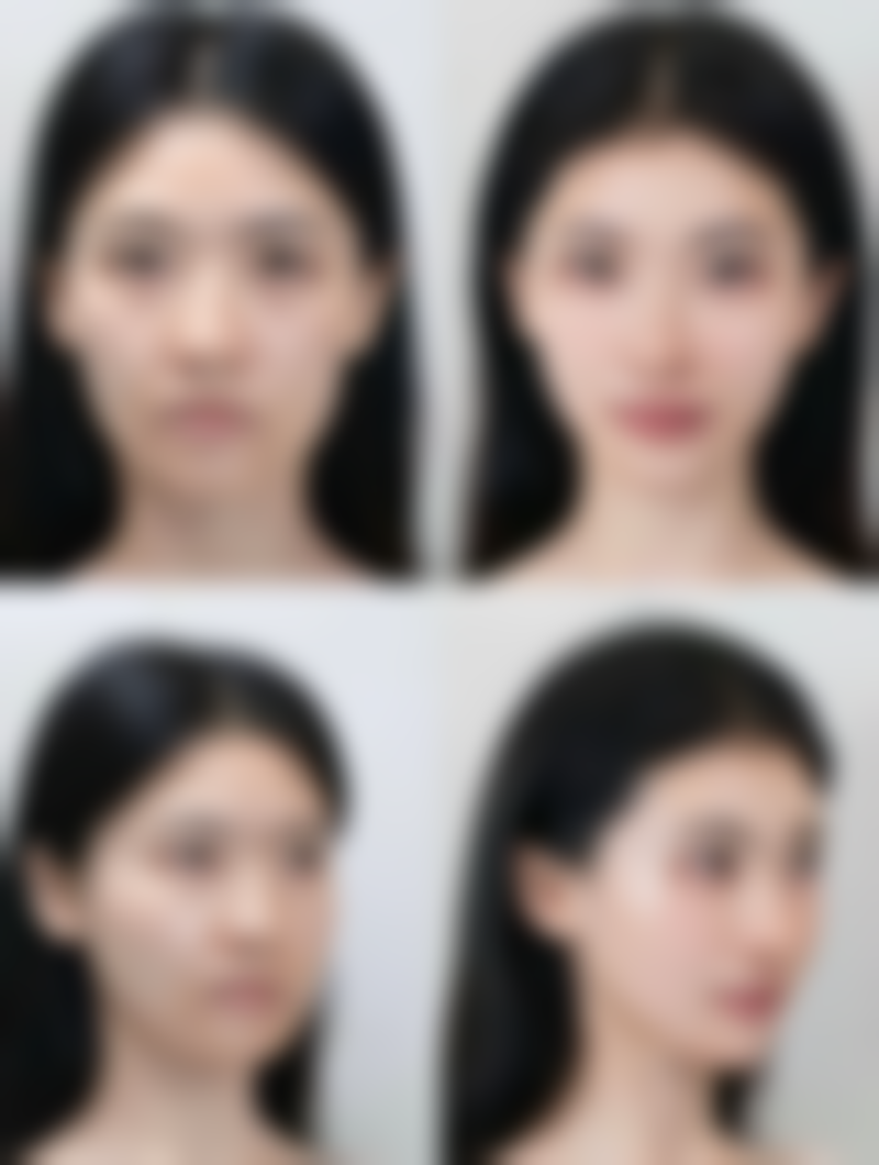 扬州市中医院医学美容中 心求美者反馈