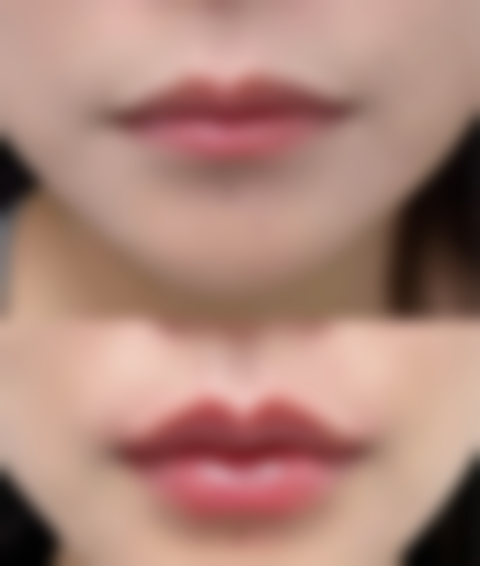 十堰淑梅娅韩医疗美容诊所求美者反馈