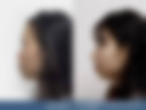 济南市艺星整形美容医院有限公司价格收费