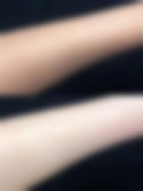 深圳凝肌医疗美容诊所价格收费