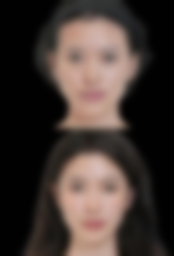 蚌埠韩美美莱医疗美容门诊部求美者反馈