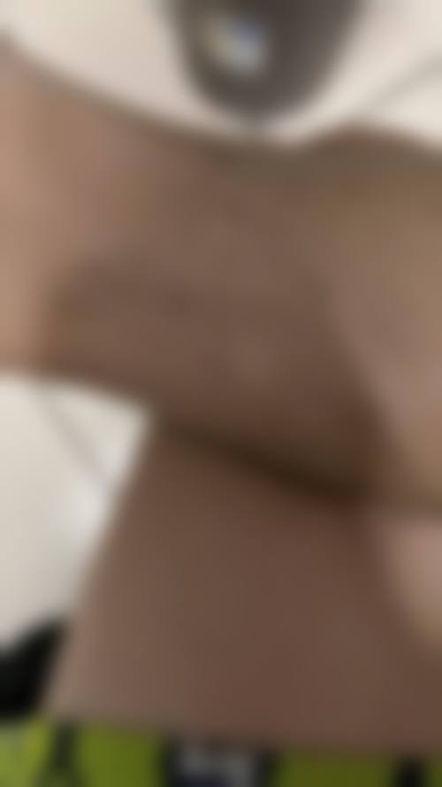 宁乡韩美医疗美容门诊部求美者反馈