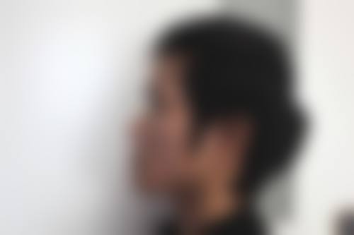 泰国TARA CLINIC整形求美者反馈